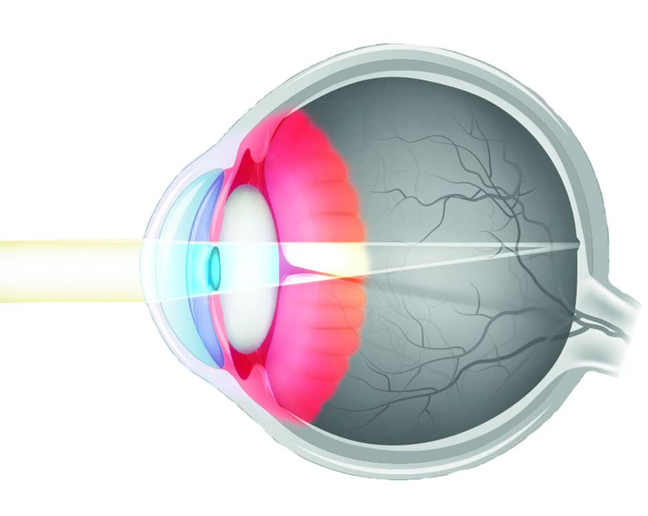 Физиологическая оптика. Анатомия глаза. Зрение на прозрачном фоне. Линзы глаз анатомия.